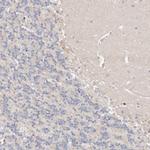 CASZ1 Antibody in Immunohistochemistry (Paraffin) (IHC (P))