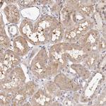 CASZ1 Antibody in Immunohistochemistry (Paraffin) (IHC (P))