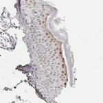 CASZ1 Antibody in Immunohistochemistry (Paraffin) (IHC (P))