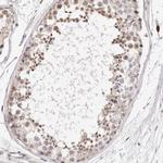 CASZ1 Antibody in Immunohistochemistry (Paraffin) (IHC (P))