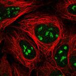 NVL Polyclonal Antibody