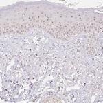 NVL Antibody in Immunohistochemistry (IHC)