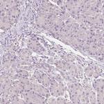 NVL Antibody in Immunohistochemistry (IHC)