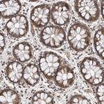 KIAA1614 Antibody in Immunohistochemistry (Paraffin) (IHC (P))