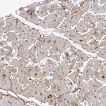 KIAA1614 Antibody in Immunohistochemistry (Paraffin) (IHC (P))