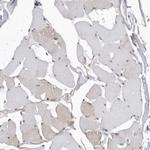 KIAA1614 Antibody in Immunohistochemistry (Paraffin) (IHC (P))
