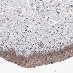 KIAA1614 Polyclonal Antibody