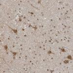 RASGEF1C Antibody in Immunohistochemistry (Paraffin) (IHC (P))