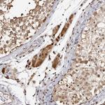 RASGEF1C Antibody in Immunohistochemistry (Paraffin) (IHC (P))