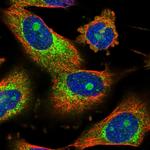 CCDC21 Polyclonal Antibody