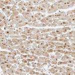ZNF407 Antibody in Immunohistochemistry (Paraffin) (IHC (P))