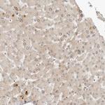 ZNF407 Antibody in Immunohistochemistry (Paraffin) (IHC (P))