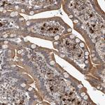 PLEKHG1 Polyclonal Antibody