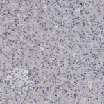 C1orf216 Antibody in Immunohistochemistry (Paraffin) (IHC (P))