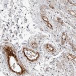 C1orf216 Antibody in Immunohistochemistry (Paraffin) (IHC (P))