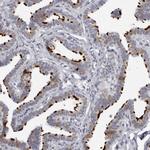 DNALI1 Antibody in Immunohistochemistry (IHC)