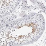 DNALI1 Antibody in Immunohistochemistry (IHC)