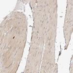SYNC Antibody in Immunohistochemistry (IHC)