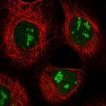 GPATCH4 Antibody in Immunocytochemistry (ICC/IF)