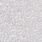 LMOD1 Antibody in Immunohistochemistry (IHC)