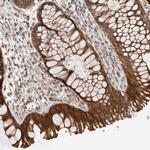FAM63A Antibody in Immunohistochemistry (Paraffin) (IHC (P))