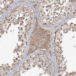 FAM63A Antibody in Immunohistochemistry (Paraffin) (IHC (P))