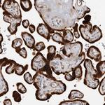 TCHH Polyclonal Antibody