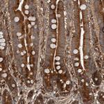 RNF207 Polyclonal Antibody