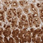 CPSF3L Polyclonal Antibody