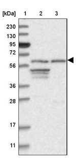 CPSF3L Antibody in Western Blot (WB)