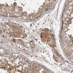 DNAJB4 Antibody in Immunohistochemistry (Paraffin) (IHC (P))
