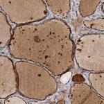 DNAJB4 Antibody in Immunohistochemistry (Paraffin) (IHC (P))