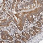PLD5 Antibody in Immunohistochemistry (Paraffin) (IHC (P))