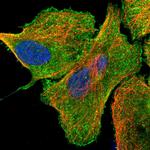 USP21 Polyclonal Antibody