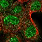 YOD1 Polyclonal Antibody