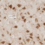 C1orf96 Polyclonal Antibody