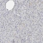 C1orf96 Antibody in Immunohistochemistry (IHC)