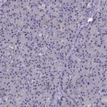 PAH Antibody in Immunohistochemistry (IHC)