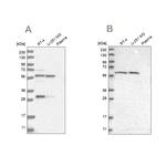 PAH Antibody in Western Blot (WB)