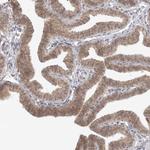 TRAPPC3 Antibody in Immunohistochemistry (Paraffin) (IHC (P))