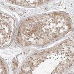 TRAPPC3 Antibody in Immunohistochemistry (Paraffin) (IHC (P))