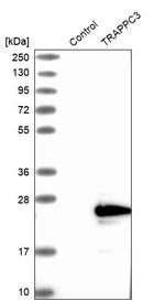 TRAPPC3 Antibody in Western Blot (WB)