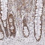 PRUNE Antibody in Immunohistochemistry (Paraffin) (IHC (P))