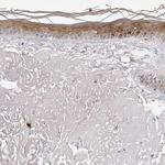 PRUNE Antibody in Immunohistochemistry (Paraffin) (IHC (P))