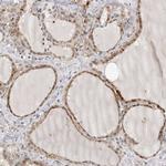 PRUNE Antibody in Immunohistochemistry (Paraffin) (IHC (P))