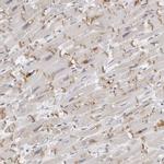 PRUNE Antibody in Immunohistochemistry (IHC)