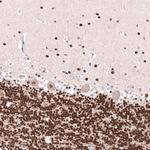 PHF20L1 Antibody in Immunohistochemistry (Paraffin) (IHC (P))