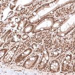PHF20L1 Antibody in Immunohistochemistry (Paraffin) (IHC (P))