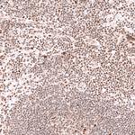 PHF20L1 Antibody in Immunohistochemistry (Paraffin) (IHC (P))