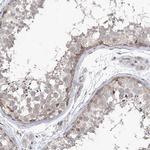 PHF20L1 Antibody in Immunohistochemistry (IHC)